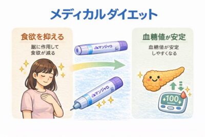 マンジャロによるメディカルダイエット/医療機関で行う新しい肥満治療のアイキャッチ画像